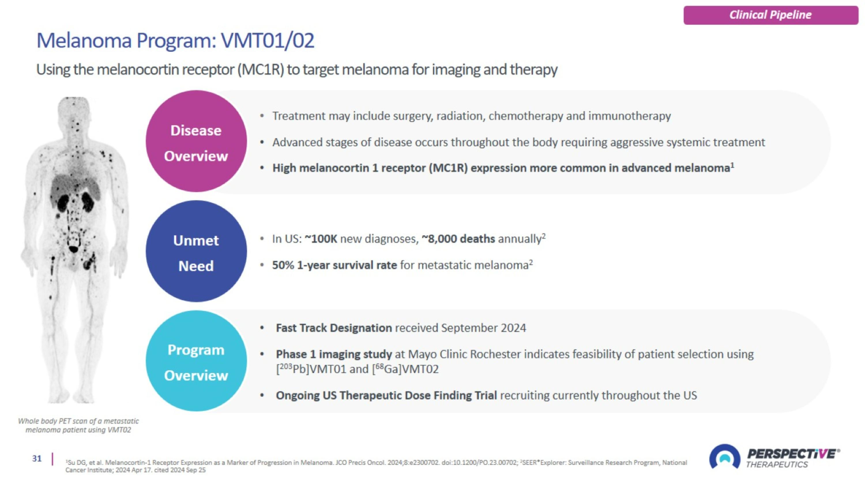 Slide 31