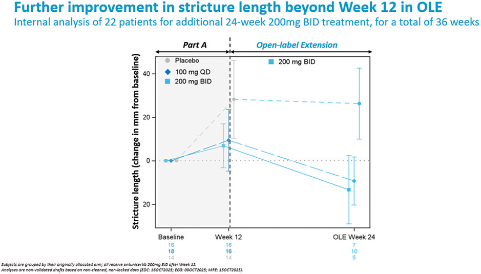 [MISSING IMAGE: lc_stricture-4clr.jpg]