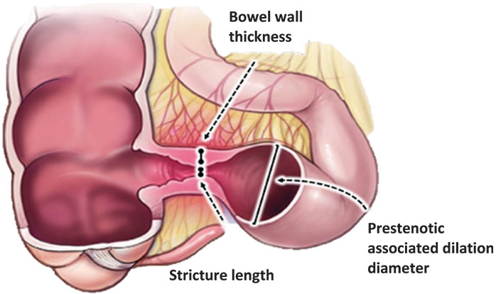 [MISSING IMAGE: ph_fscdsprc-4clr.jpg]