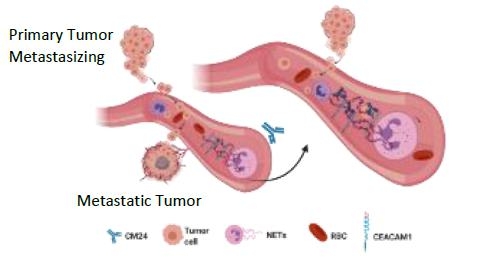 A diagram of a tumor  Description automatically generated