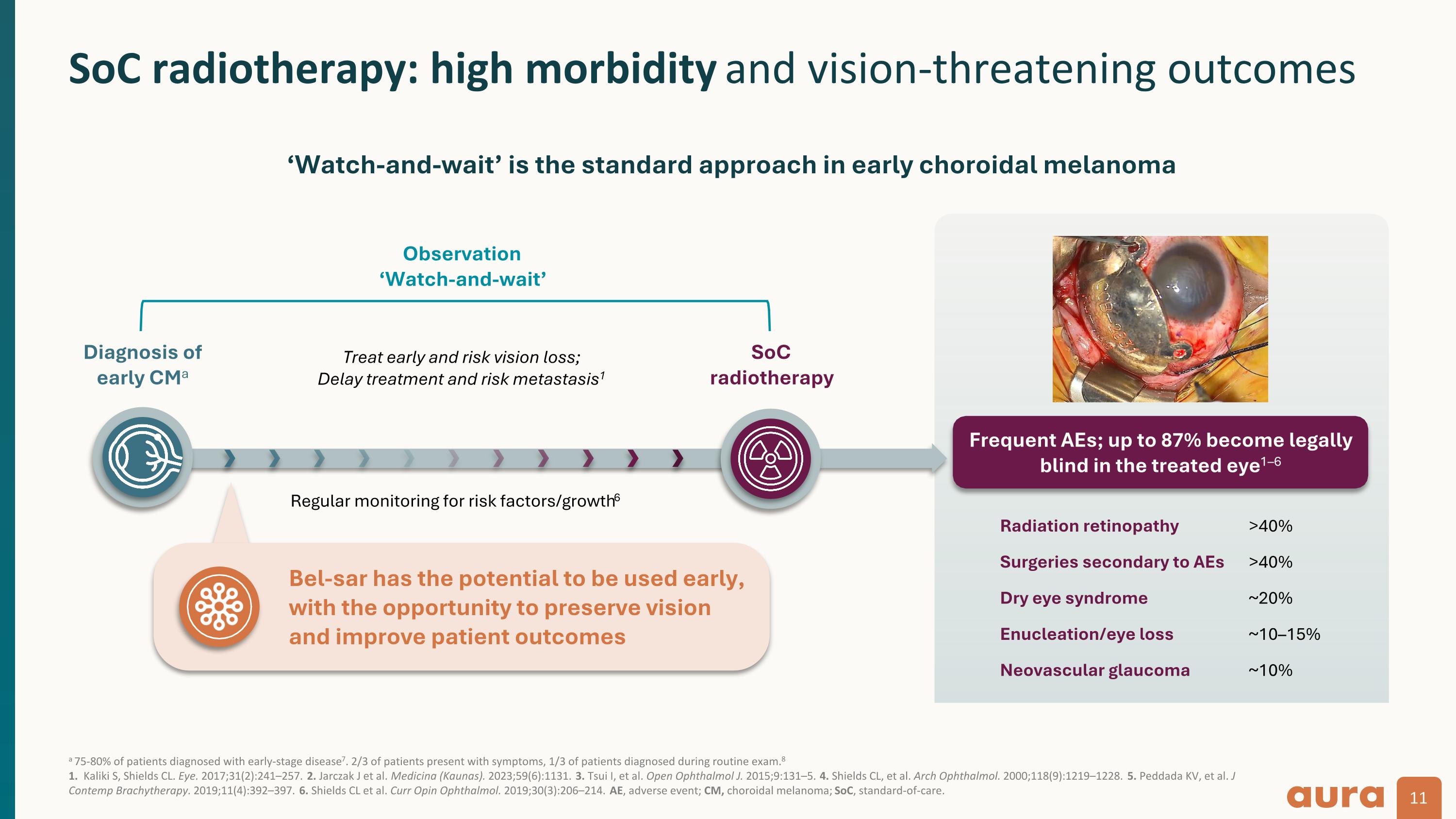 Slide 11