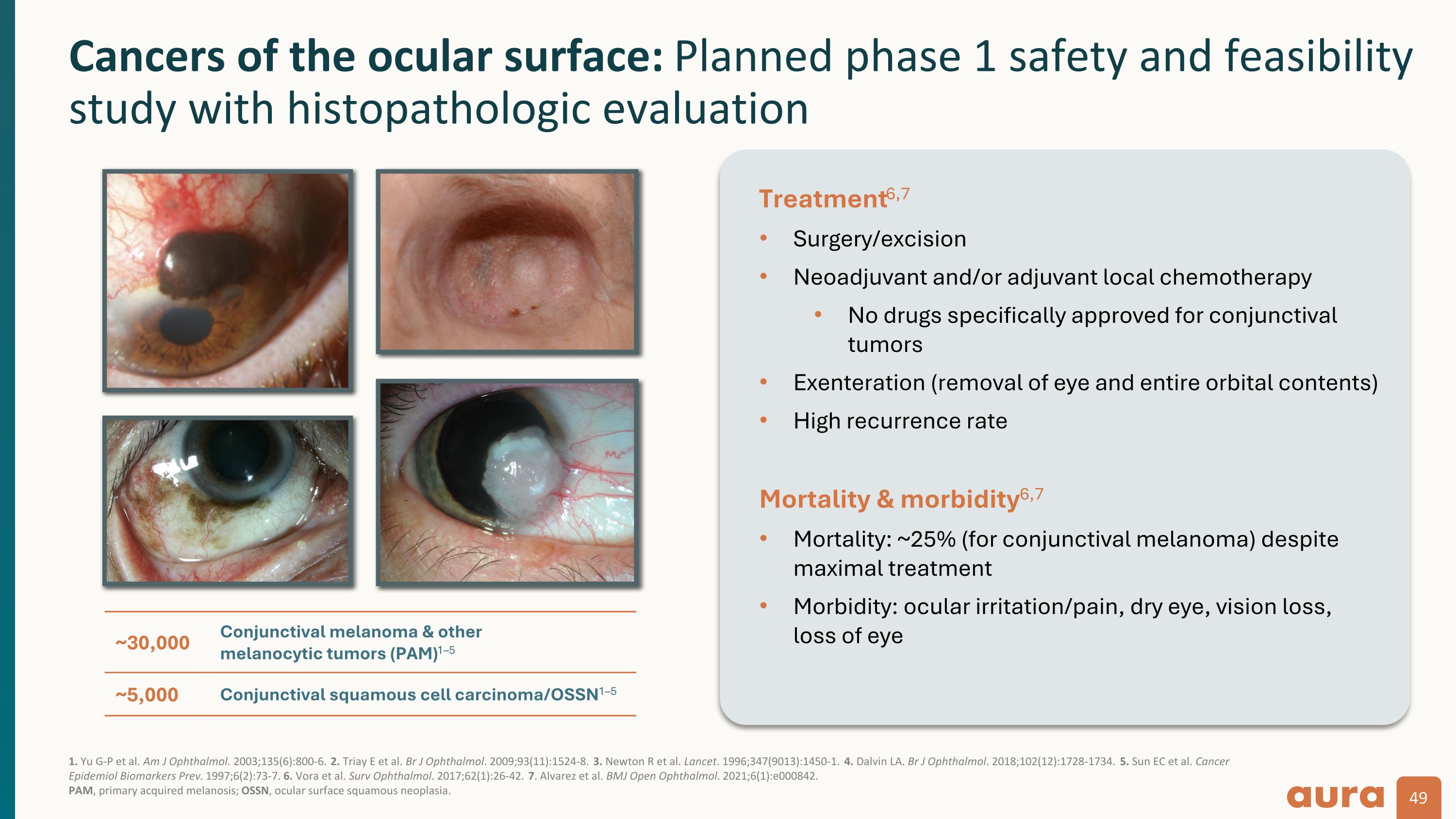 Slide 49