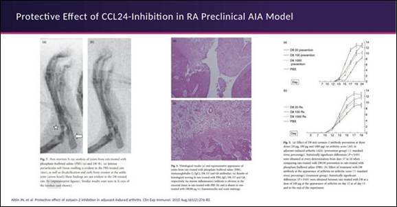 The image illustrates a scientific study showing the beneficial impact of CCL24 inhibition in reducing arthritis in a preclinical adjuvant-induced arthritis (AIA) model, supported by a graph demonstrating the inhibition effects.

AI-generated content may be incorrect.
