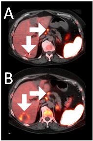 A close-up of a ct scan

AI-generated content may be incorrect.